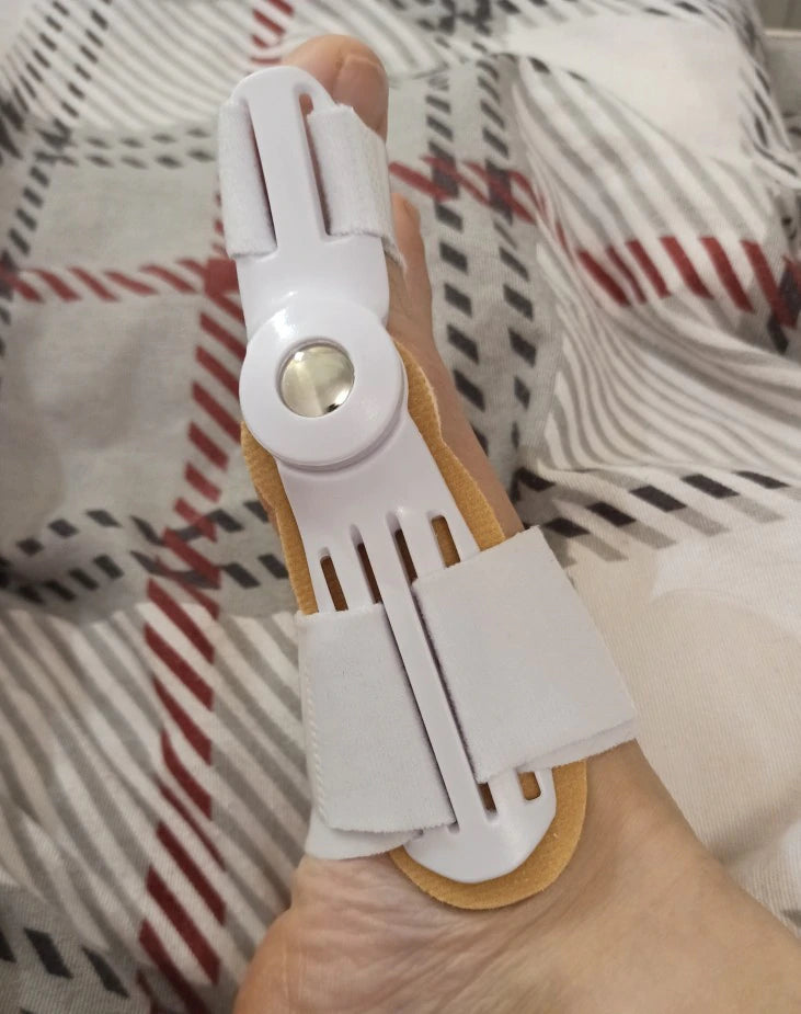 Kimberly's foot with the Pedineo® corrector